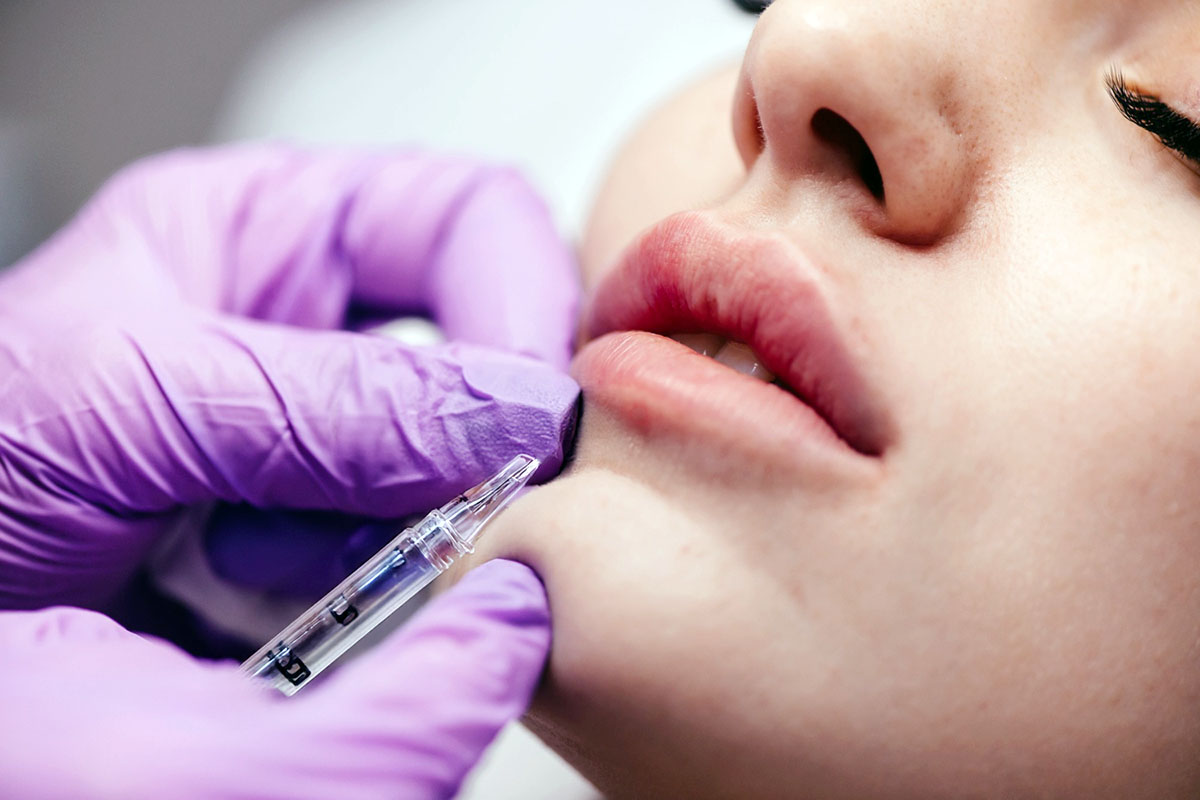 Hyaluron Pen Lip Filler