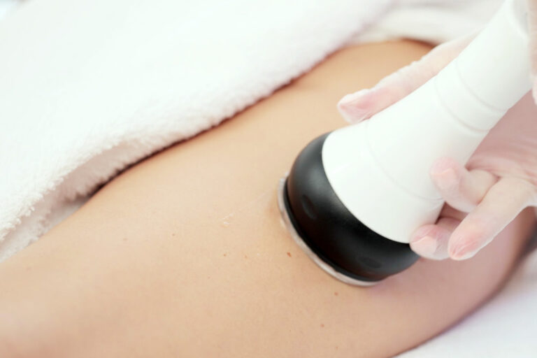 cellulite treatment